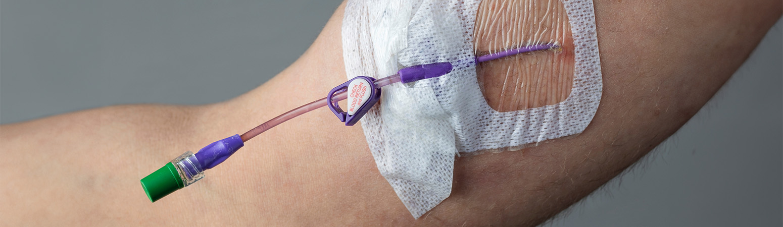 Close-up of a secured catheter line in a patient's arm, prepared for PICC line removal.